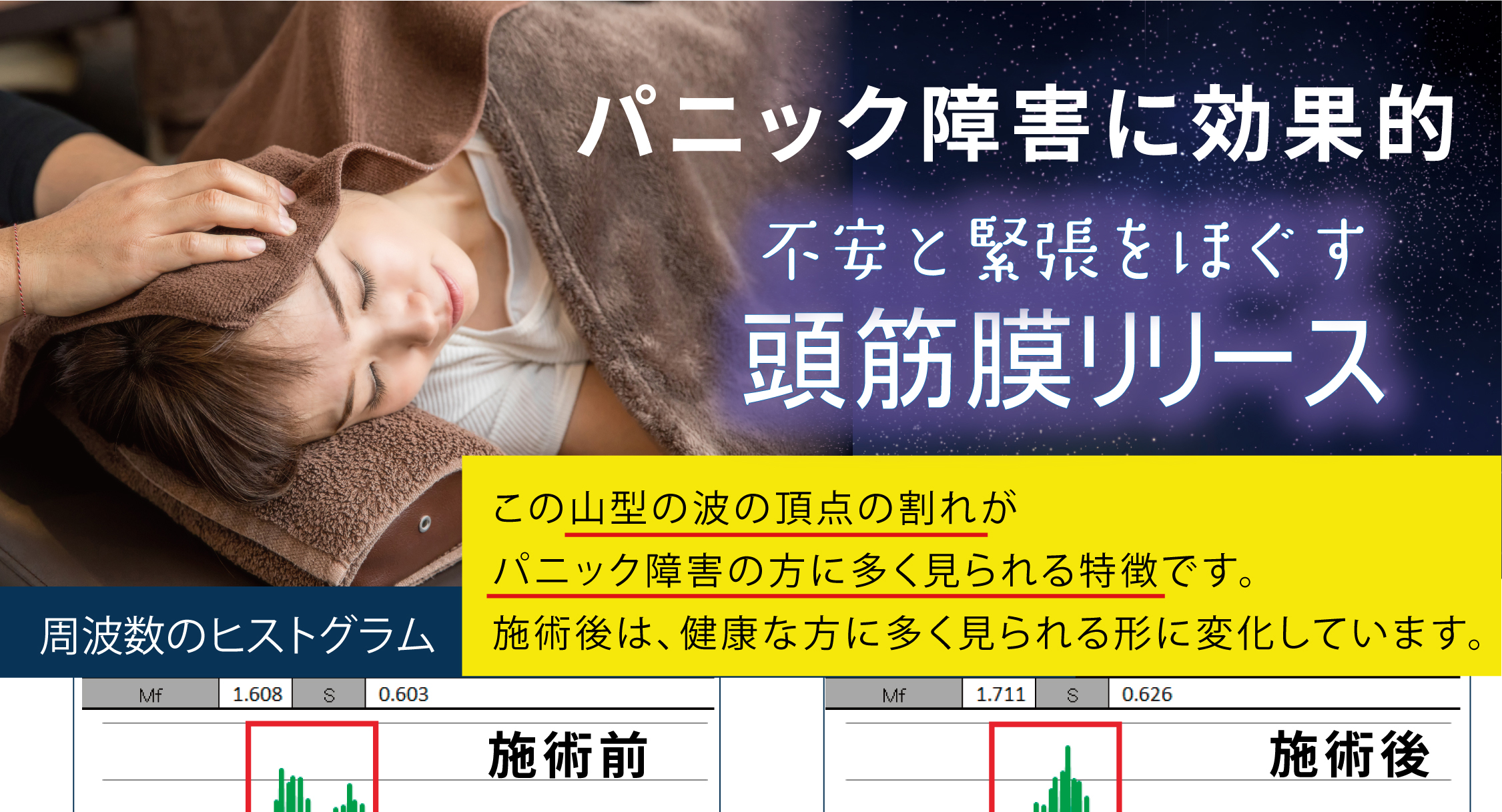 パニック障害に効果的「頭筋膜リリース」体験談