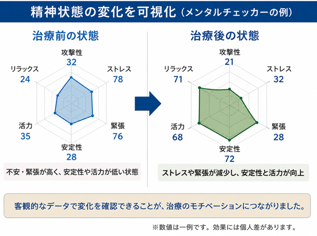 精神状態の変化を可視化、治療前と治療後の状態