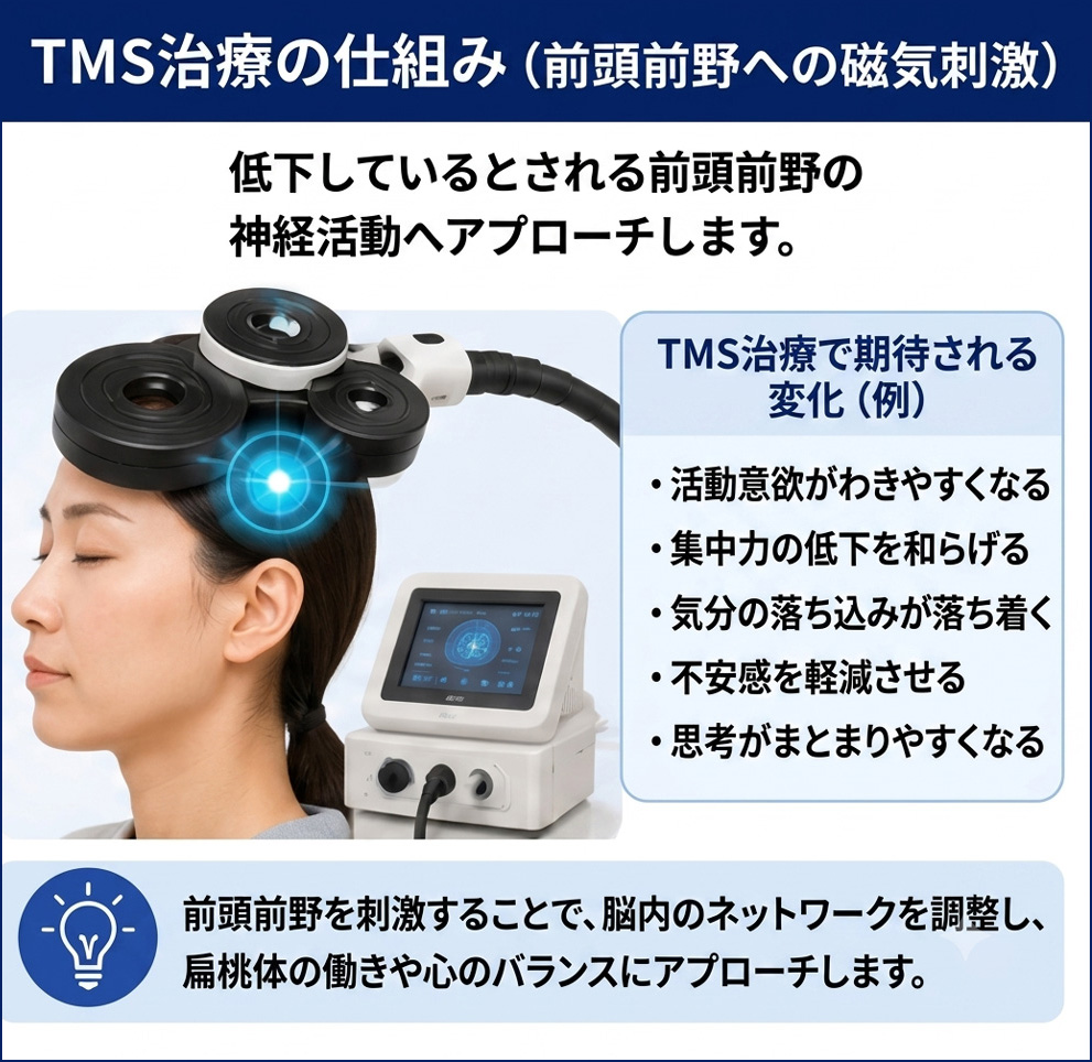 TMS治療の仕組み