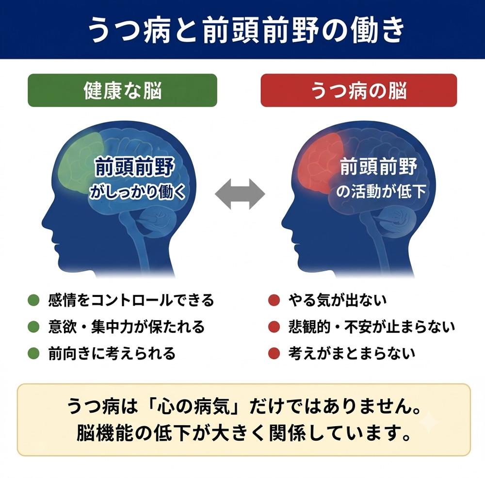 うつ病と前頭前野の働き