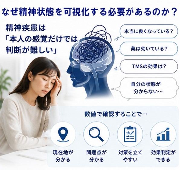 TMS治療の効果は本当にある？精神測定で「見える化」する仕組み